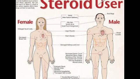 피부과, 만병통치약의 두 얼굴, 스테로이드, 약물의 부작용, 쿠싱증후군, 보름달 얼굴, 튼살유발, st침, 자향미한의원