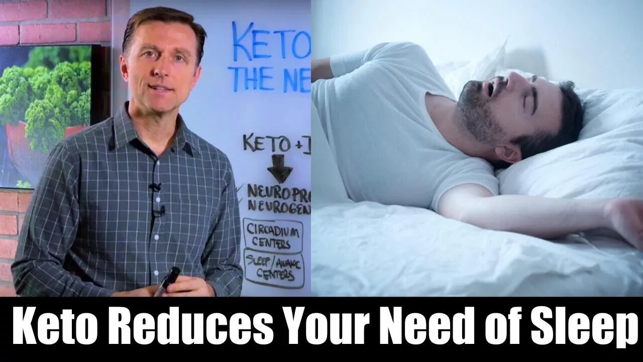 Keto & Intermittent Fasting Reduces Need For Sleep – Dr. Berg