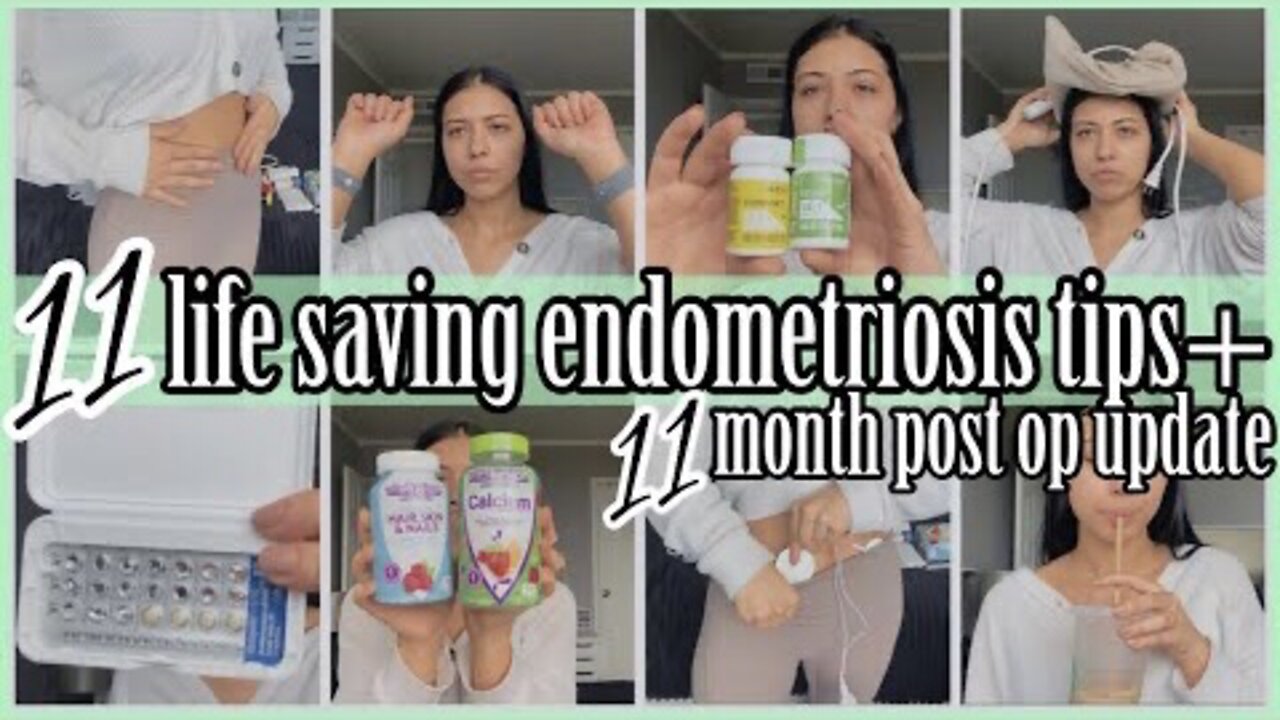 11 LIFESAVING ENDOMETRIOSIS TIPS 2022|11 MONTH LAPAROSCOPIC EXCISION SURGERY POST OP UPDATE|ez tingz