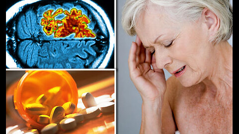 Leaked this confidential memory tonic reverses Alzheimer’s