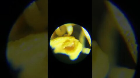 How Exactly looking in Microscope 🔬 of Some Living things & Objects.. #microscope