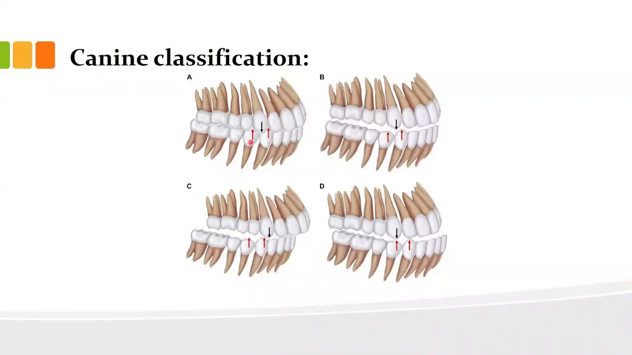 orthodontics L3 (malocclusion)