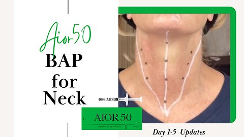 Aior50 Neck Hydration - BAP Markings