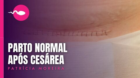 QUANTAS CESÁREAS O CORPO DE UMA MULHER CONSEGUE SUPORTAR? | Patrícia Moreira