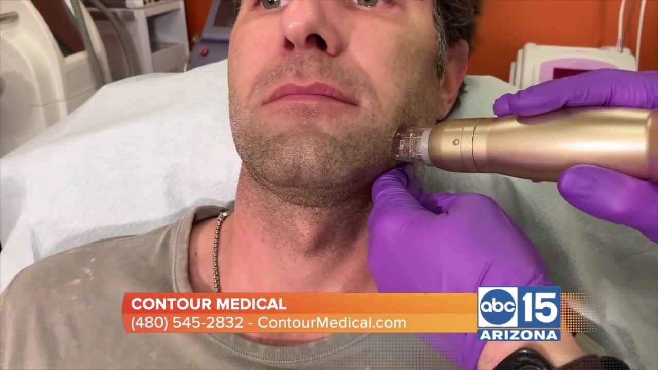 Contour Medical: One treatment that can help with many different skin issues