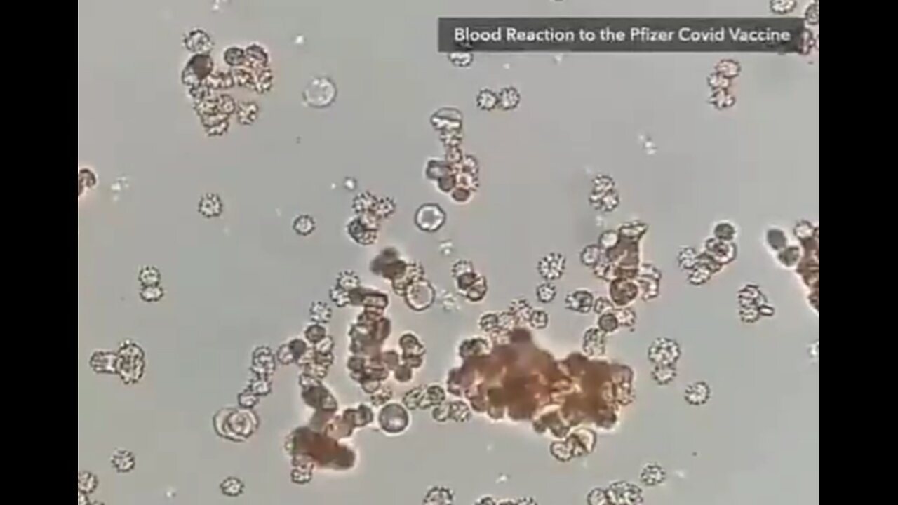 HOW BLOOD REACTS TO 4 DIFFERENT VACCINES