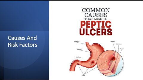 Peptic Ulcers - Causes & Risk Factors