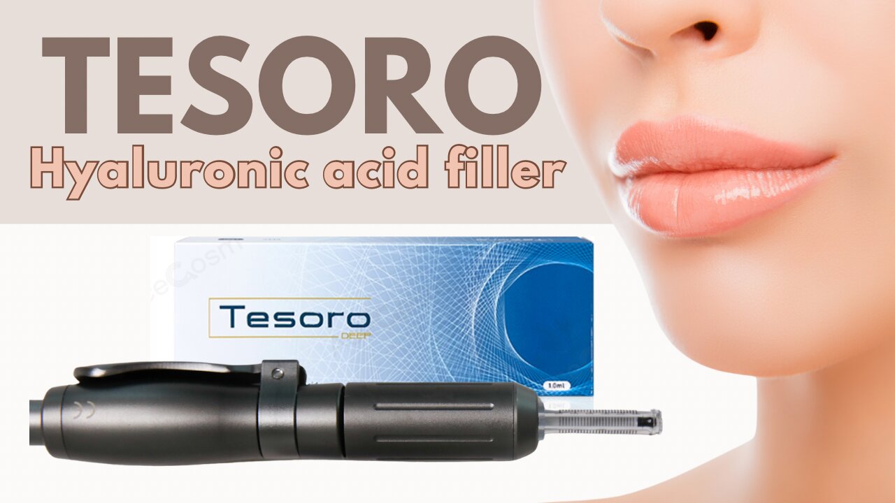 TESORO Hyaluronic Acid Filler // acecosm.com CODE beautylab10 for 10% off