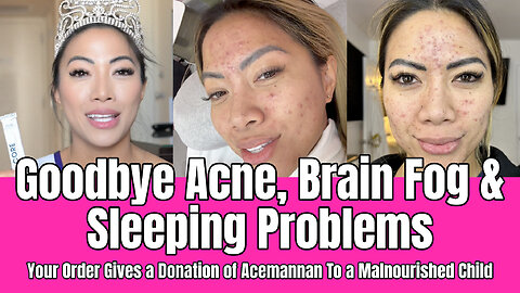 Goodbye Acne, Brain Fog & Sleeping Problems