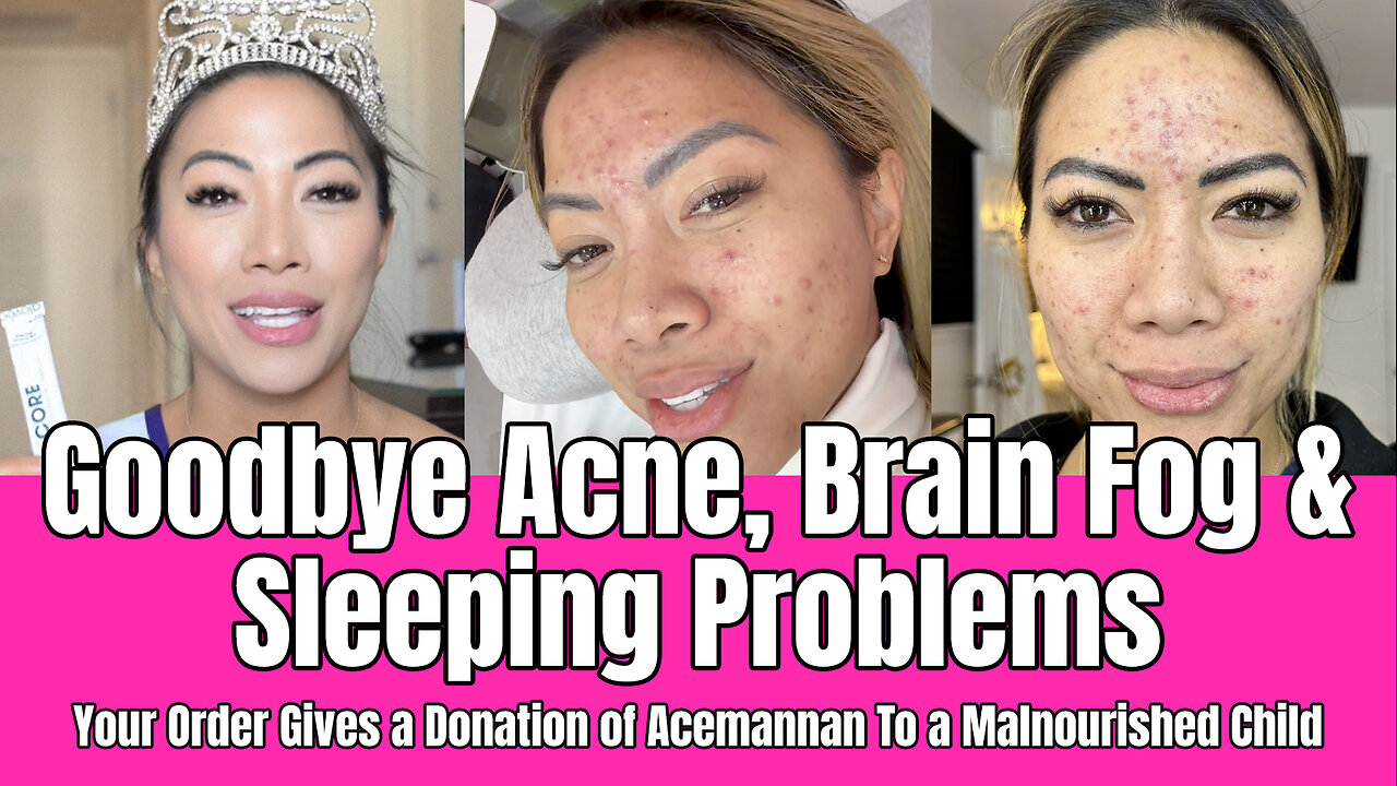 Goodbye Acne, Brain Fog & Sleeping Problems