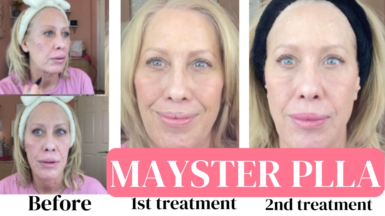 Round 2 Mayster -Find out all the details from before & after