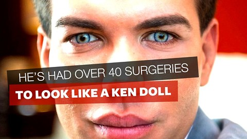 He’s Had 40 Surgeries To Look Like A Ken Doll, But After Taking A Vacation He Says “Never Again”