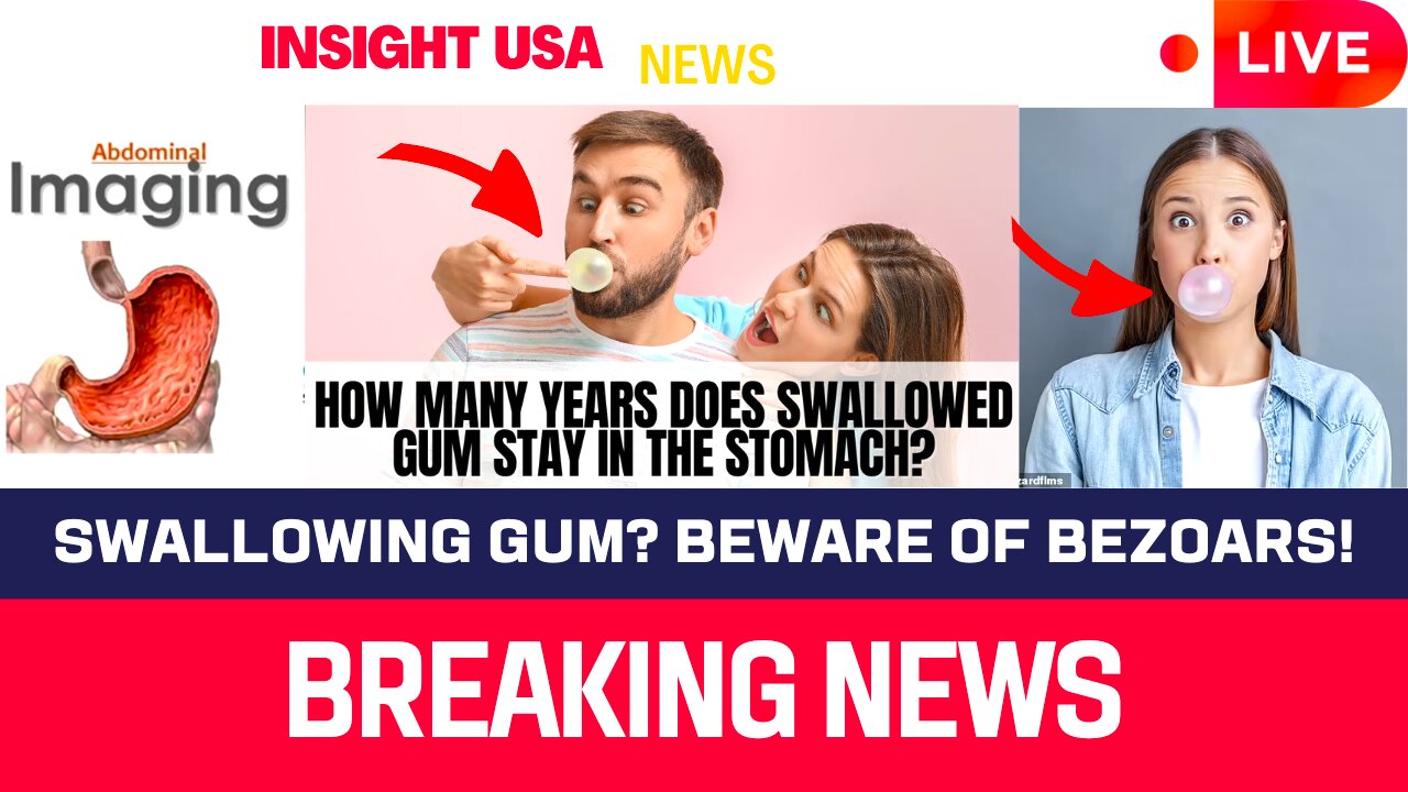 Swallowing Gum? Beware of Bezoars!