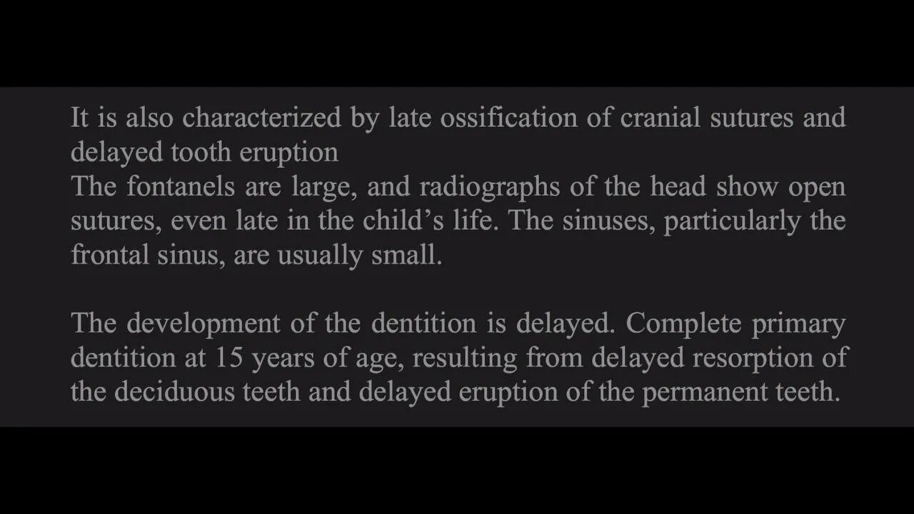 Pedodontics L9 (Systemic factors influence time of eruption)