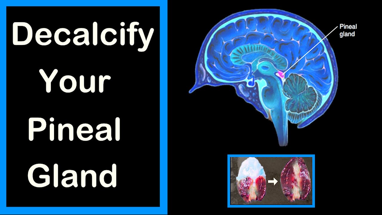 DEcalcify your Pineal Gland | Doorway to awakening your highest spiritual potential