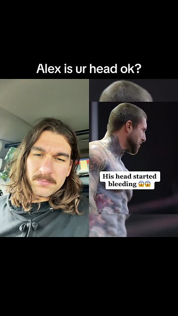 Alex Terrible Bashes Head #alexterrible