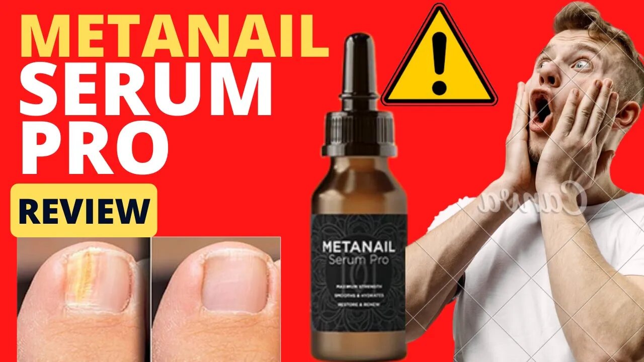 How To Fight Nail Fungus 3X Faster Even While Sleeping - Metanail Complex Review