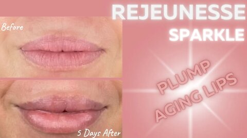 Lip Plumping with Rejeunesse Sparkle