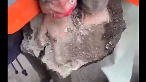 Activists in Germany used concrete & epoxy resin to glue their hands to road, may require amputation
