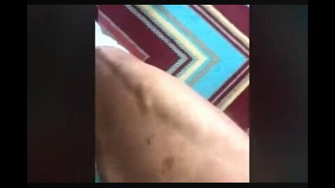 Vaxxed man says he is morphing into something else. Very strange.