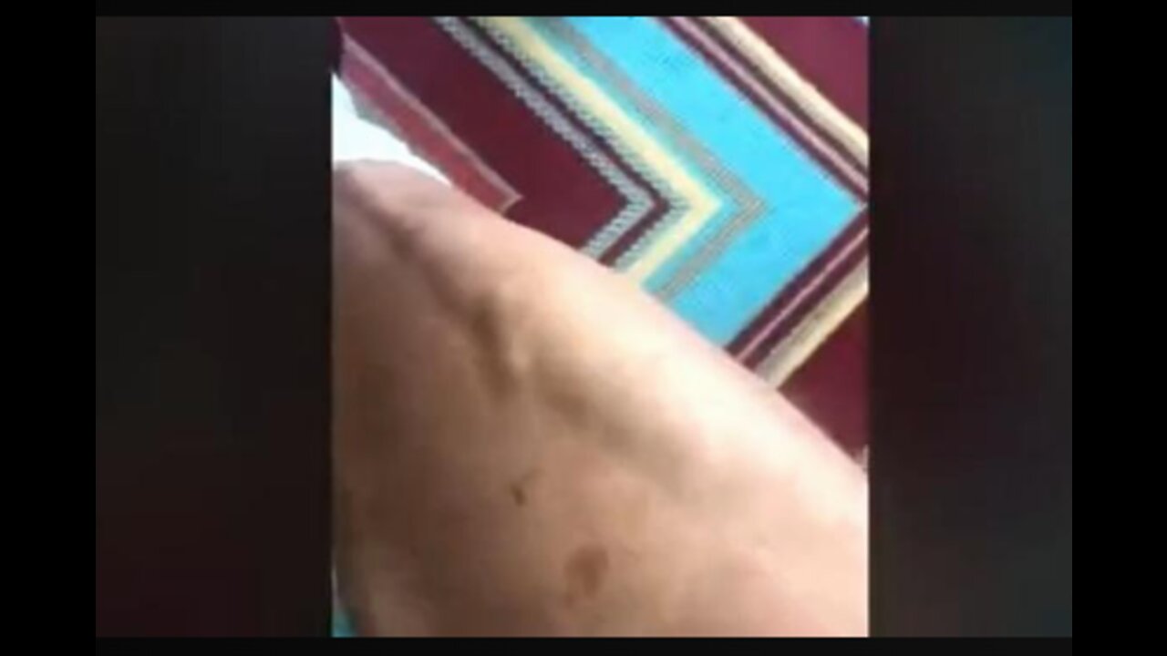 Vaxxed man says he is morphing into something else. Very strange.
