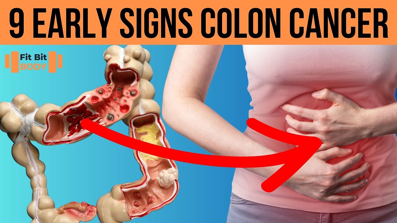 9 Early Signs of Colon Cancer Don't Ignore