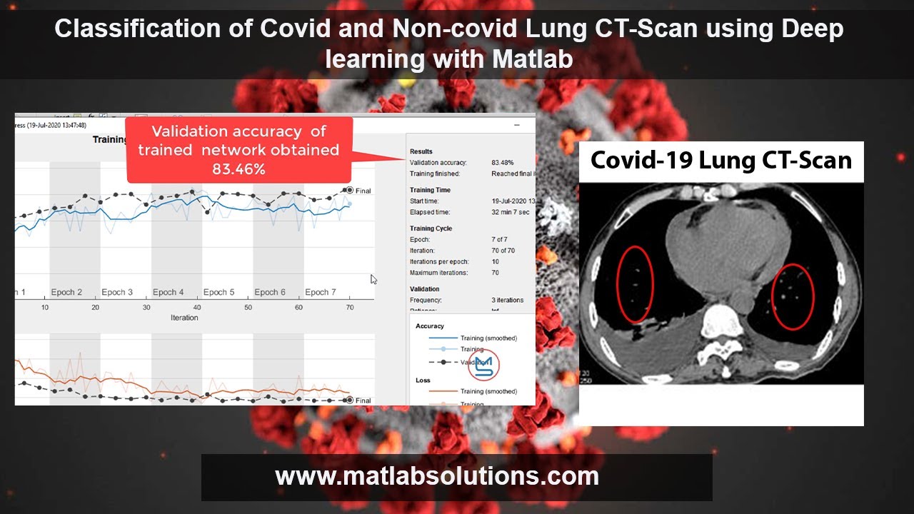 Classification of Covid and Non-Covid Lungs CT-Scan using Deep Learning with MATLAB| MATLABsolutions