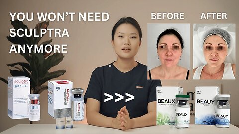 The best alternative to SCULPTRA | BEAUX, BEAUY, AestheFill