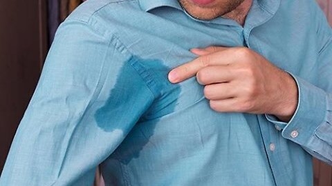 HOW TO MANAGE EXCESSIVE SWEATING?