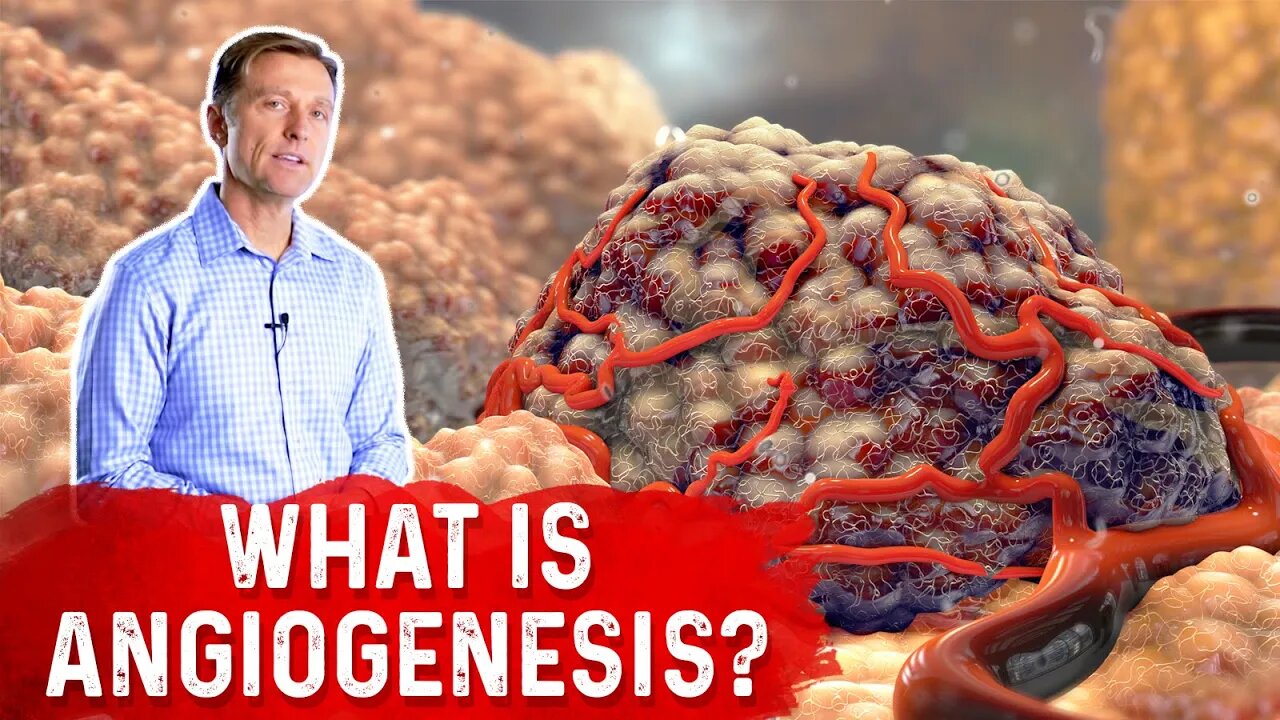 What is Angiogenesis? – Dr. Berg