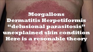 Morgellons Black Goo Harald Kautz Vella English