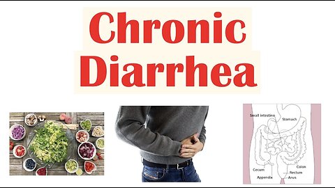 Chronic Diarrhea: Approach to Cause, Secretory vs Osmotic vs Inflammatory, Watery vs Bloody Diarrhea