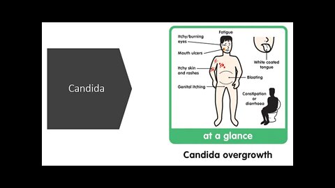 Candida Natural Treatment