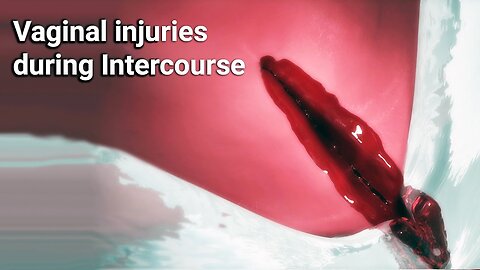 Vaginal injuries during intercourse#VaginalInjuries #IntercourseSafety