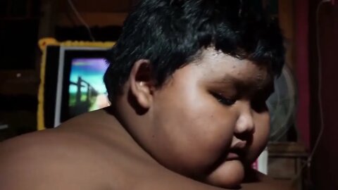 The world's heaviest child in the media spotlight 3