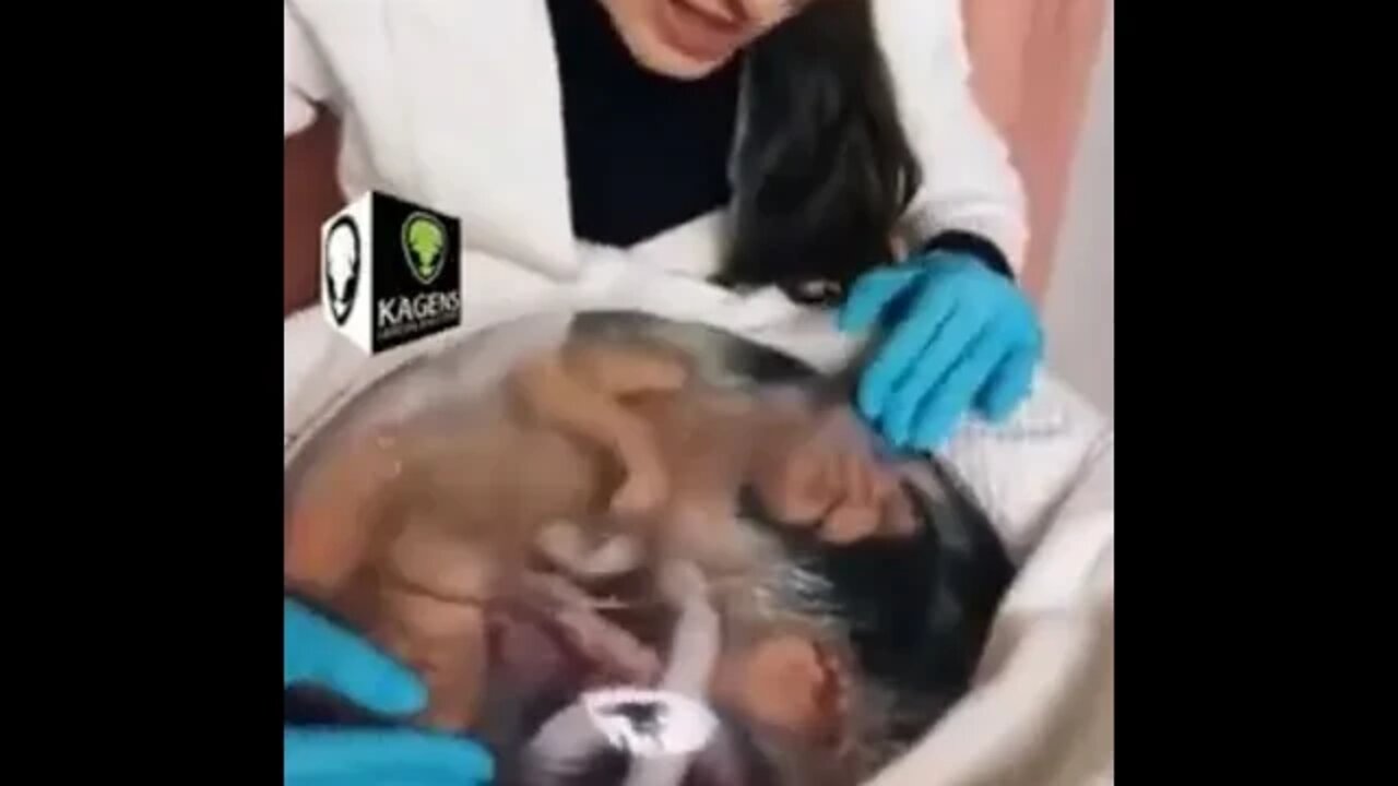 Do you want to grow a baby in a bag?