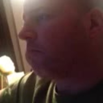 Wife laughs as man on anesthetic falls asleep mid chew