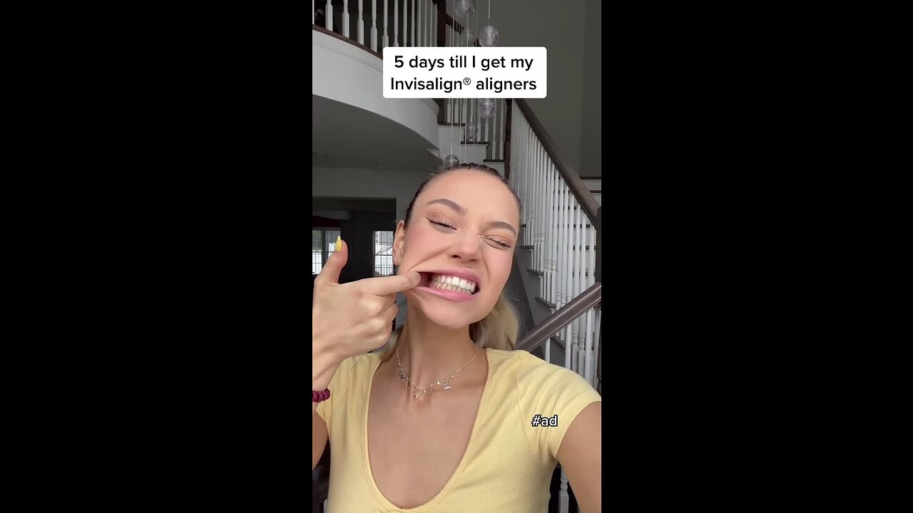 excited to start my invisalign journey! link in bio to take the smile assessment! #ad #invisalign #