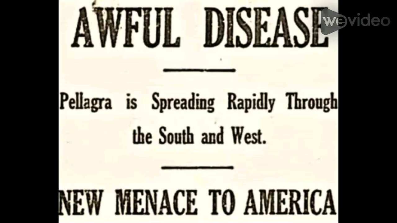 President Warren Harding versus Pellagra and Democrats