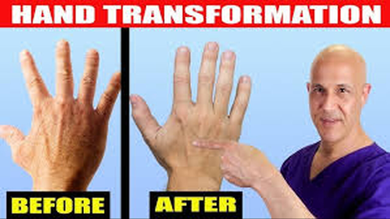 Transform Wrinkled, Dry, Aged Hands...Look Younger with This Natural Elixir! Dr. Mandell