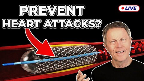 I Was Wrong About Stents