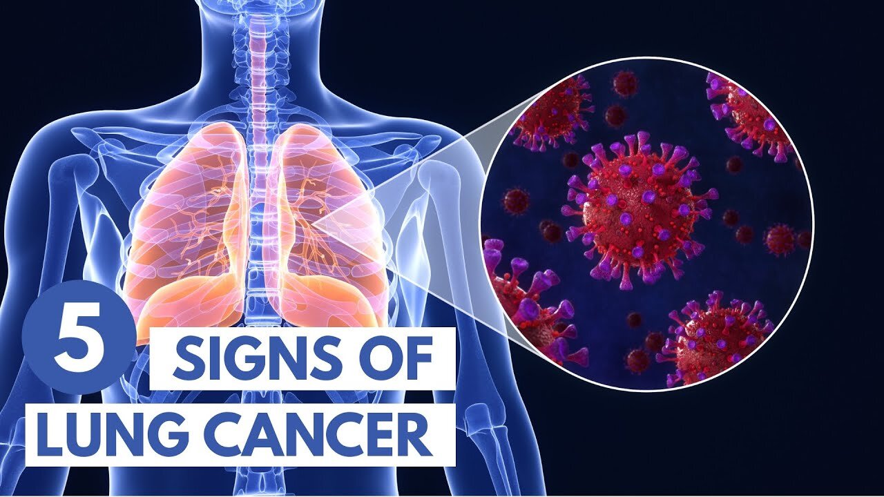 5 Signs of Lung Cancer | 3D Animation