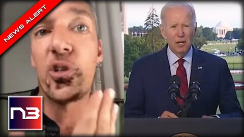 It’s An EMERGENCY: Biden Just Made Huge Decision on Monkeypox