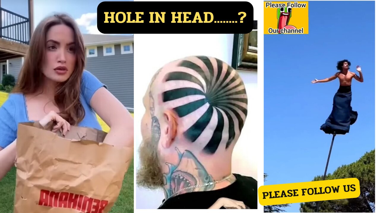 Hole in Head😧😧😧😧😧| Sir me Hole |