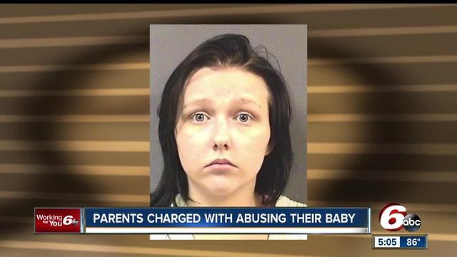 Infant found with multiple bone fractures; parents taken into police custody