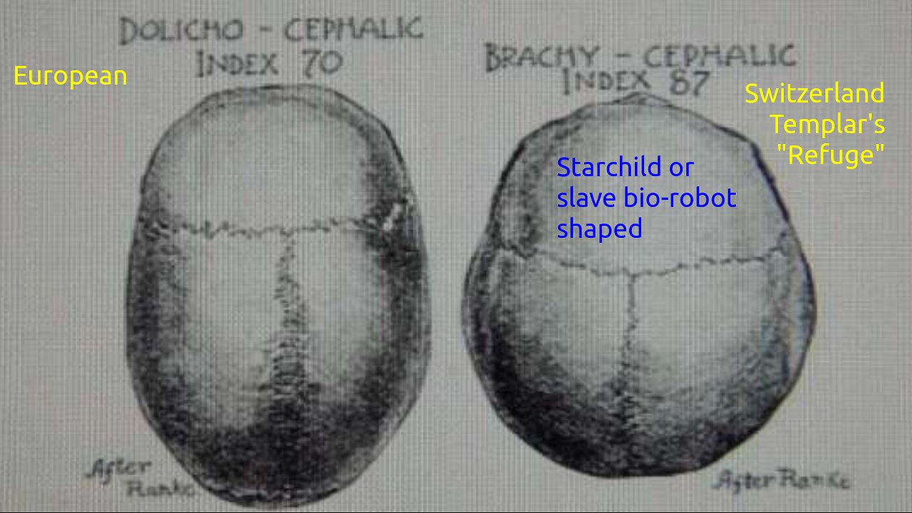 Brachy-Cephalic Swiss Freemasons and Templars are the Secret European Cancer (Sean Hross)