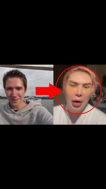 Delusional Man Risks His LIFE to Become Asian