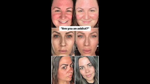 Skincare Ingredient that Changed Everything