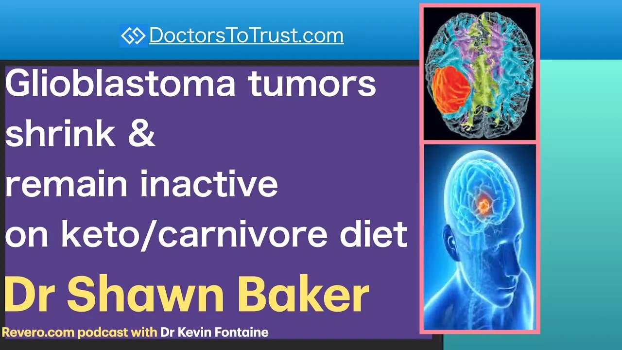 Shawn Baker 2 | Glioblastoma tumors shrink & remain inactive on keto/carnivore diet