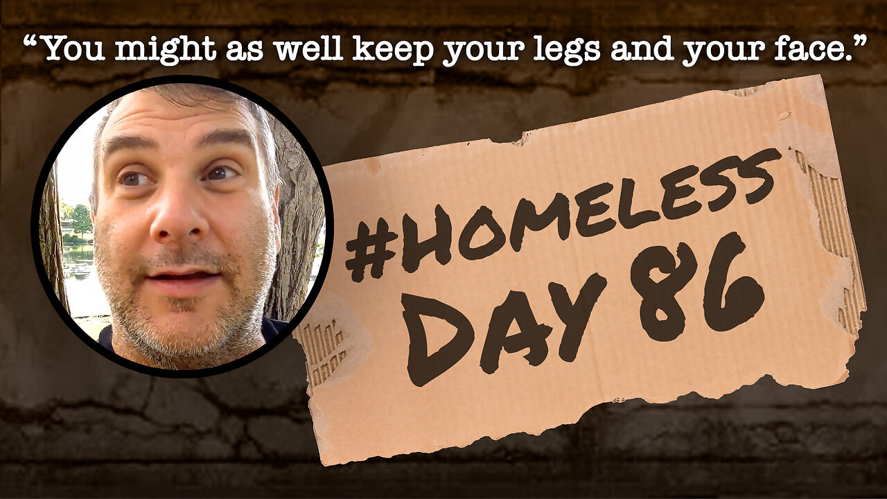 #Homeless Day 86: “You might as well keep your legs and your face.”